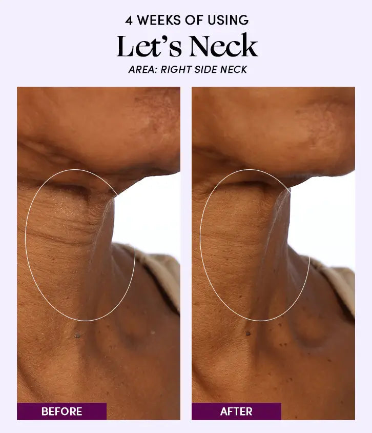 Image of Womaness - Let's Neck - Neck Serum w/ Cooling Applicator: 1.7 oz