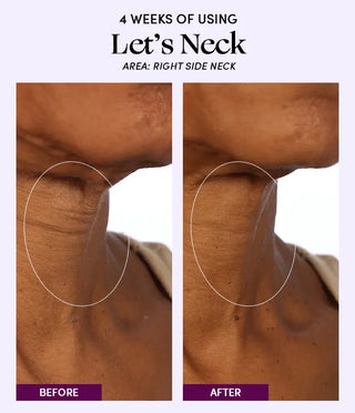 Womaness - Let's Neck - Neck Serum w/ Cooling Applicator: 1.7 oz