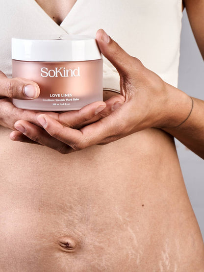 SoKind - Love Lines Emollient Stretch Mark Balm