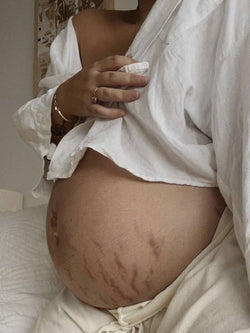 Image of SoKind - Love Lines Emollient Stretch Mark Balm
