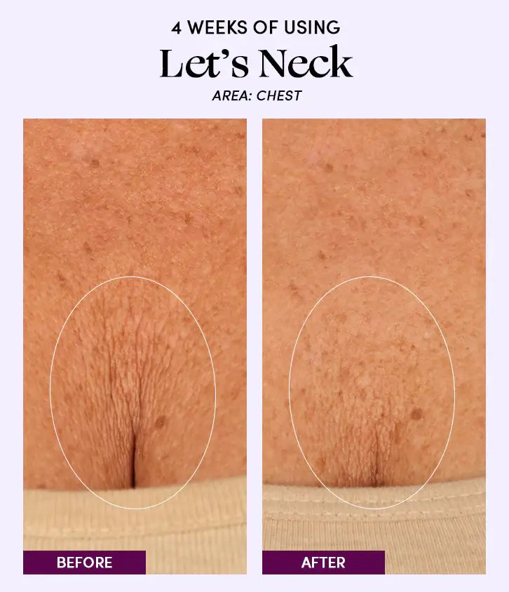 Image of Womaness - Let's Neck - Neck Serum w/ Cooling Applicator: 1.7 oz