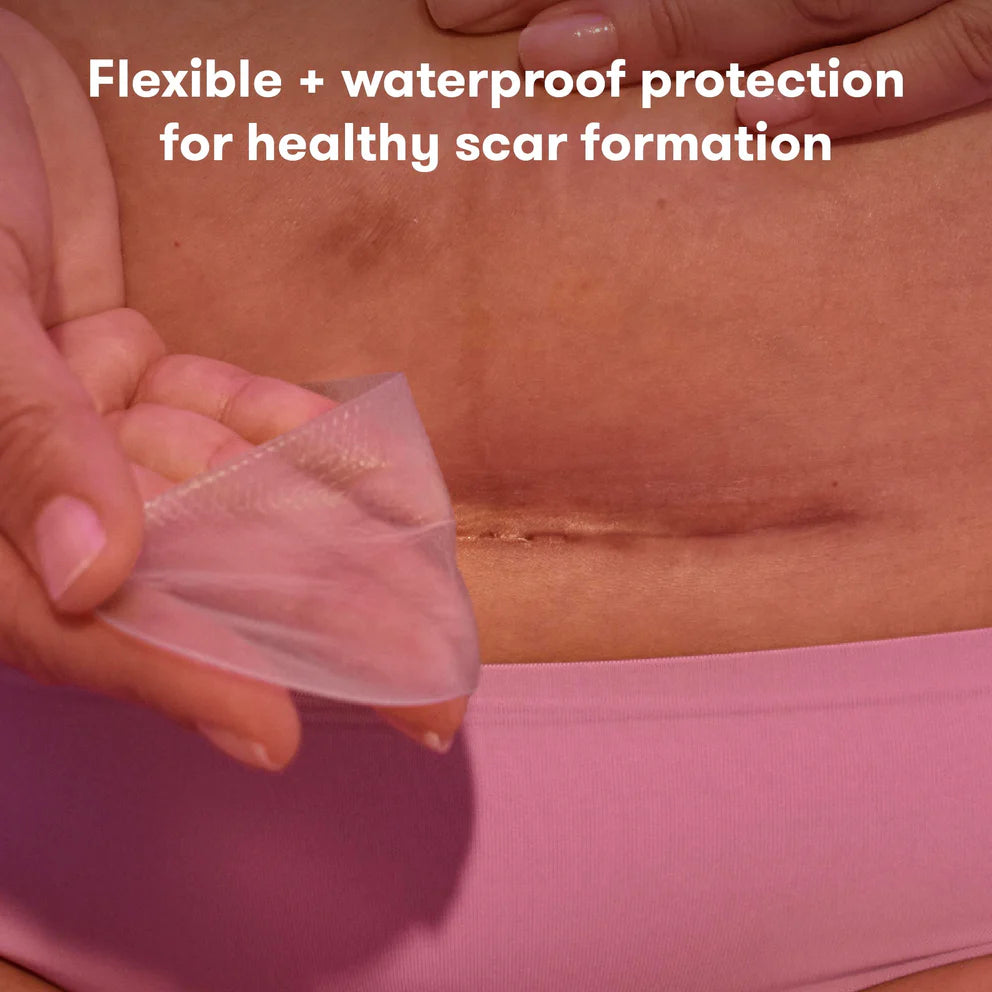 Image of Frida C-Section Silicone Scar Patches