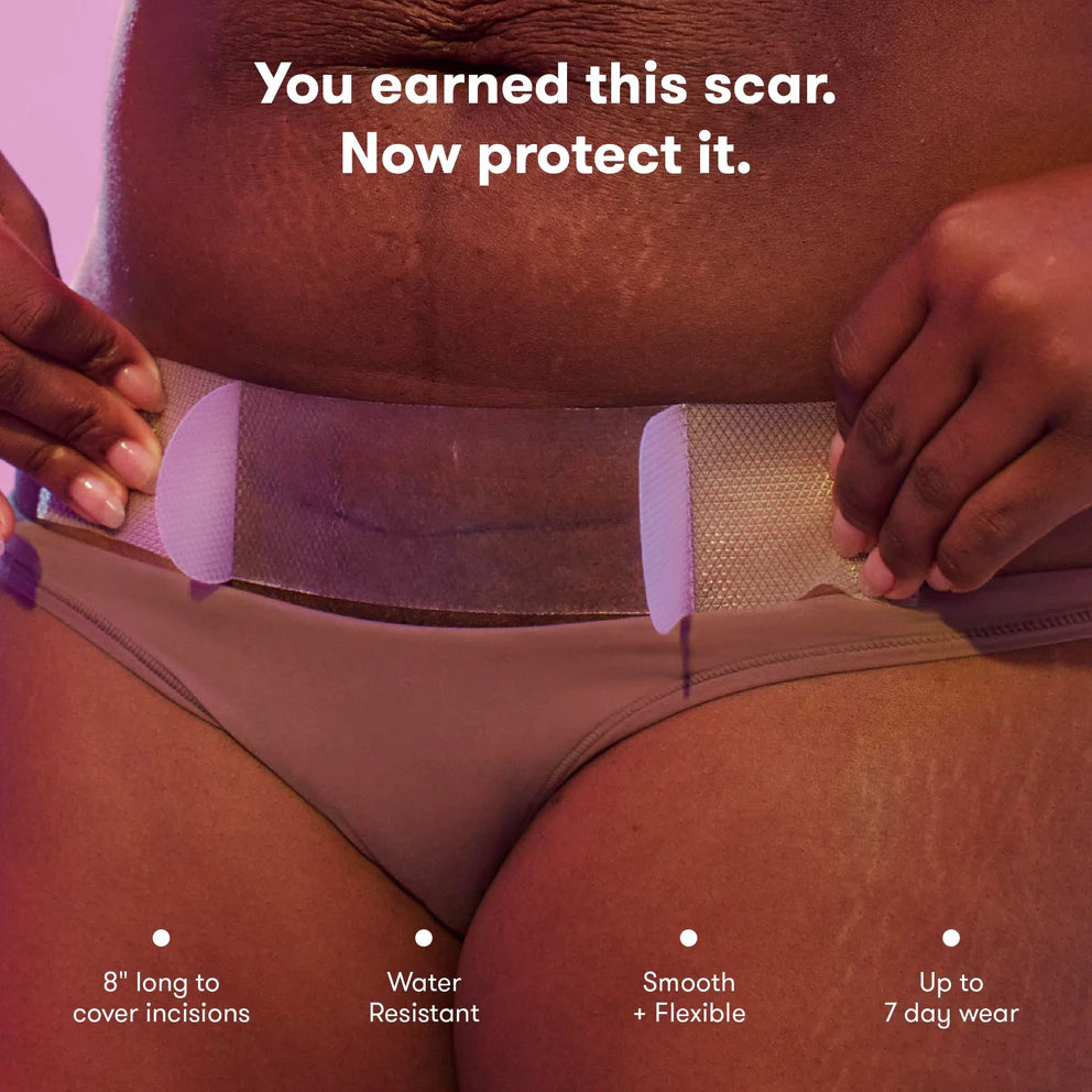 Image of Frida C-Section Silicone Scar Patches