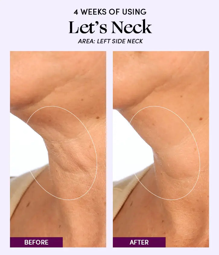 Image of Womaness - Let's Neck - Neck Serum w/ Cooling Applicator: 1.7 oz