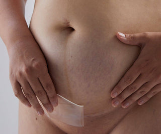 Bare Mum - Silicone Gel Scar Strips